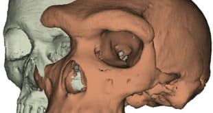 صورة ثلاثية الأبعاد لجمجمة بشرية حديثة وعضو في سلالة Homo heidelbergensis مقدمة من جامعة يورك البريطانية. (أ ف ب)