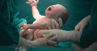 لحظة ولادة طفل في أحد المستشفيات. (أرشيفية)